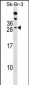 RAP2B Antibody (Center)